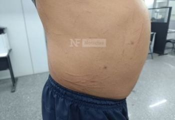 Criminosos atiram contra motorista durante assalto na BR 356, em Campos